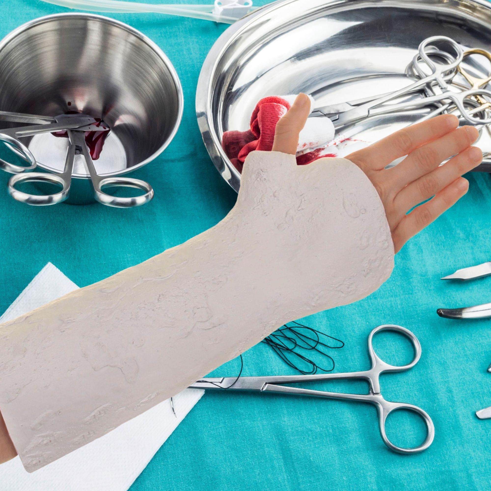 Novelty Arm Cast Dress Accessory Costume Accessory