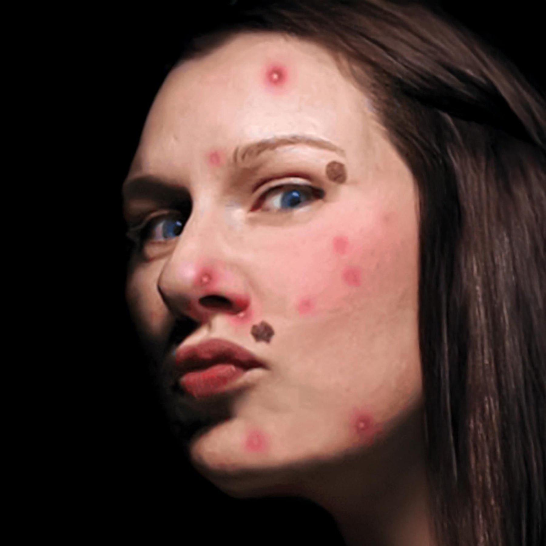 Skin Condition Gorywood Temporary Tattoos Costume Accessory