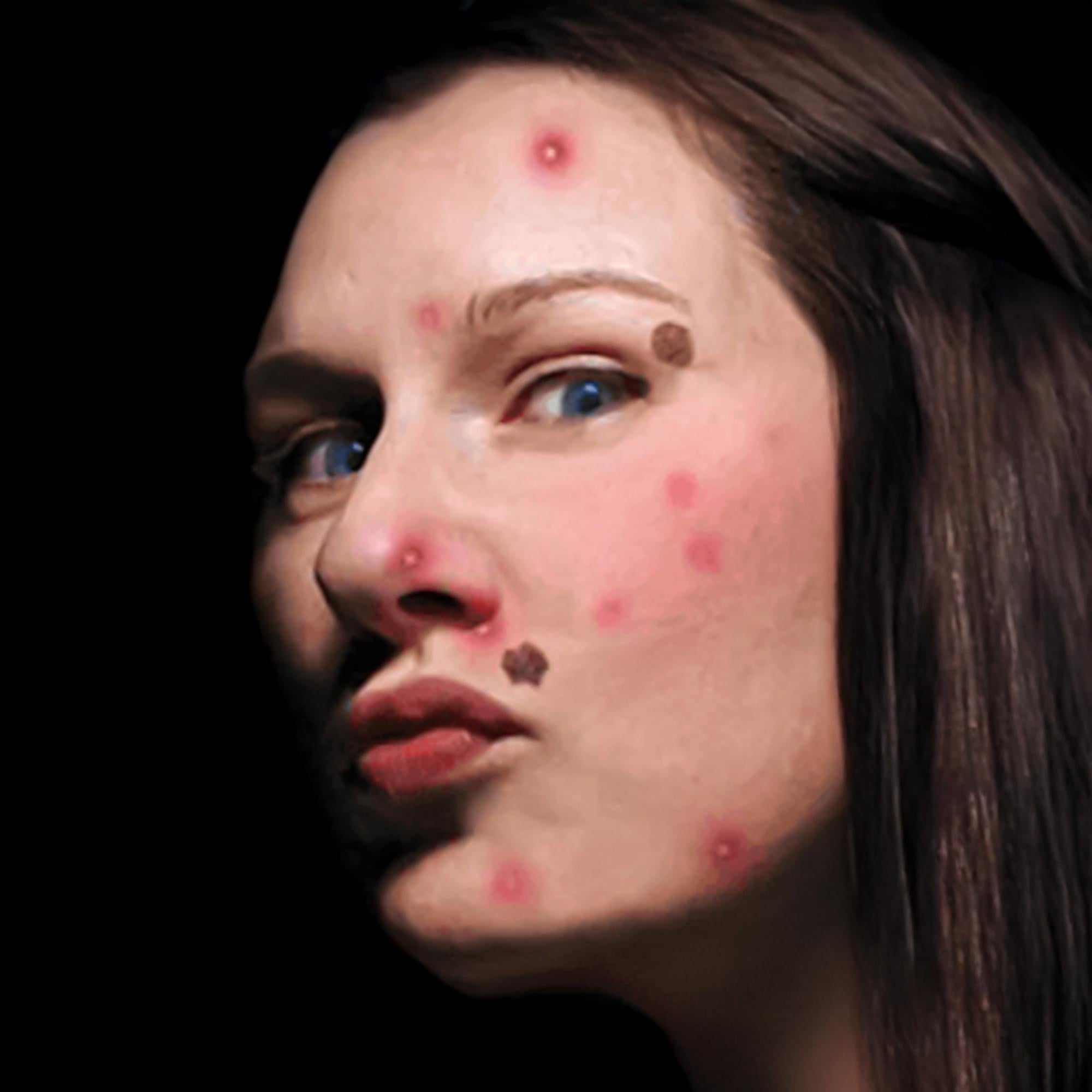 Skin Condition Gorywood Temporary Tattoos Costume Accessory