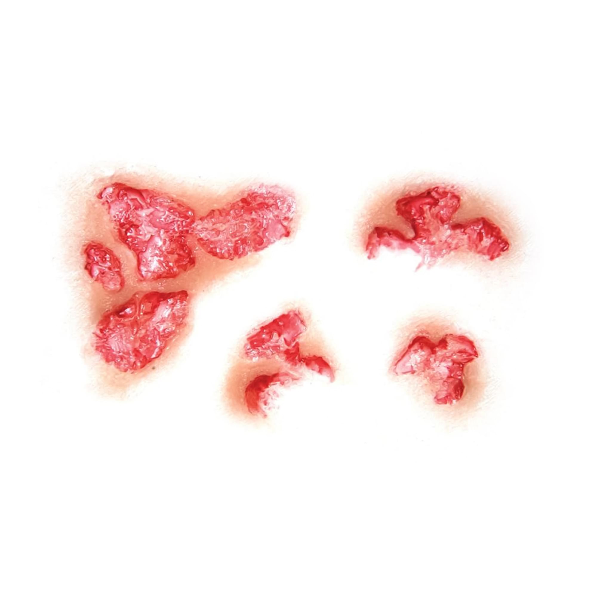 Burned Flesh 3d Fx Transfers Costume Accessory